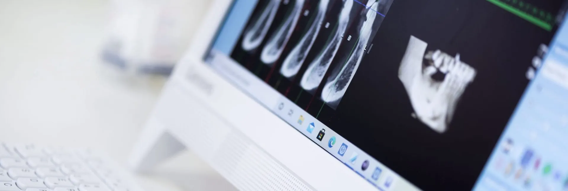 Monitor de Enamel Clínica Dental mostrando radiografías dentales y una reconstrucción en 3D